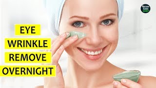 HOW TO REMOVE UNDER EYE WRINKLES OVERNIGHT [upl. by Ahcorb]