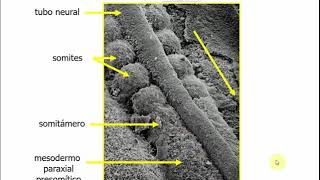 Histología CBCC5  T18a  Embrión somítico Desarrollo del sistema músculo esquelético parte 1 [upl. by Assenay]