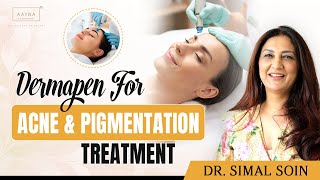 Dermapen Microneedling For Acne Scars Open Pores Wrinkles amp Pigmentation Treatment  AAYNA Clinic [upl. by Eniluqcaj]