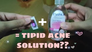 VLOG23  Cheap Acne Solution  Dalacin C and Eskinol  Tipid Skin Care [upl. by Akeylah]