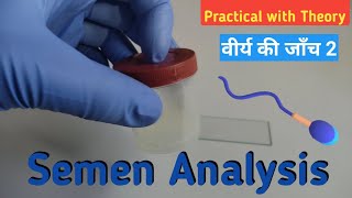 Semen Analysis  Microscopic examination  Sperm count  Sperm  sperm cell  वीर्य टेस्ट  Semen [upl. by Dennison761]