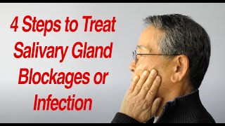 4 Steps to Treat Salivary Gland Swelling at Home [upl. by Swigart168]