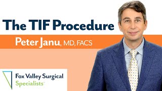 TIF Procedure for HeartburnRefluxGERD with Dr Janu [upl. by Alecram]