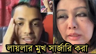 লায়লার মুখ সার্জারি করালায়লা আমাকে মারছেলাইভে মামুন কি বলছে দেখুন [upl. by Marla666]