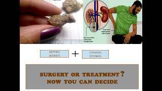 KIDNEY STONE renalcalculi renalcare casepresentation [upl. by Adiuqram293]