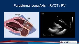 Part 2 Comprehensive TTE in Adults Webinar [upl. by Vanna]