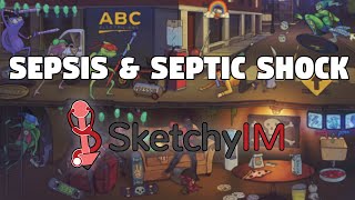 Sepsis amp Septic Shock  SketchyIM USMLE Step 2 Review [upl. by Byram219]