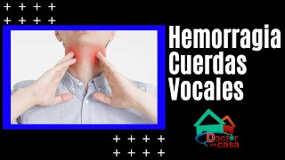 Hemorragia de cuerda vocal [upl. by Randi619]