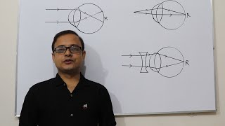 চোখের ত্রুটি ও প্রতিকার easy  Eye Defect  Myopia  Hypermetropia  Nearsightedness  SSC Physics [upl. by Hsekar]