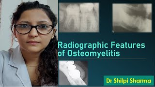 Radiographic Features of Osteomyelitis [upl. by Merdith]