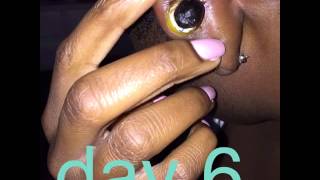 Keloid Removal Rubber Band Process [upl. by Venn]