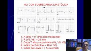 ELECTROCARDIOGRAFIA CURSO TALLER 7 HIPERTROFIAS VENTRICULARESwmv [upl. by Zerlina]