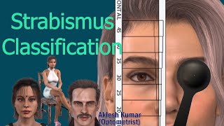 Strabismus classification  Types of squint [upl. by Violet]