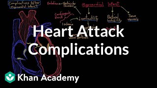 Complications after a heart attack myocardial infarction  NCLEXRN  Khan Academy [upl. by Edi]