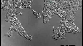 Pseudomonas aeruginosa twitching motility YFPPilU [upl. by Bliss]