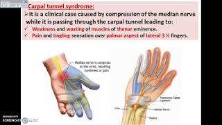 Hand and Wrist Bones Sectional Anatomy with MRI Insight in Axial Coronal Sagittal Plains [upl. by Niamrahc]