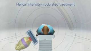 TomoTherapy  Revolutionary Radiation Therapy [upl. by Nasya]