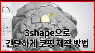 3shape 싱글 코핑 제작 방법 [upl. by Eleanor924]