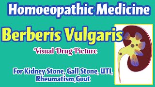 Berberis Vulgaris Homoeopathic Medicine Uses  Symptoms  Renal Stone Gall Stone Renal Colic [upl. by Alrzc]