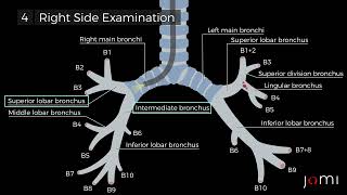 Flexible Bronchoscopy and Bronchoalveolar Lavage BAL [upl. by Ashla]