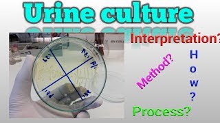 Urine culture test procedure Microbiology [upl. by Aicelef]