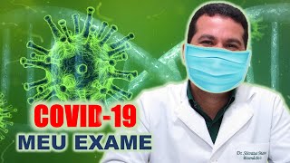 IgM IgG PCR  Testes para Coronavirus e Diagnóstico da COVID19 [upl. by Foy]