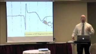 The 6 Causes ST Segment Elevation on an EKG ECG [upl. by Finbur]