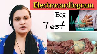 ECG QRS NOMENCLATURE [upl. by Nedle]