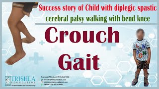 Success story of Child with diplegic spastic cerebral palsy walking with bend knee Crouch gait [upl. by Antsirhc]