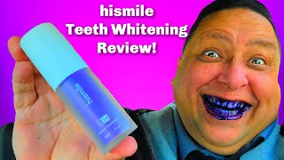 I tried hismile™ Teeth Whitening V34 Color Corrector Serum Did it work [upl. by Asiaj804]