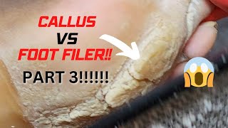 CALLUS VS FOOT FILER PT 3 [upl. by Longmire]