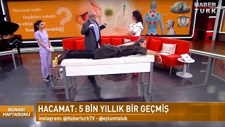 Hacamat Tedavisi Gençleştirir mi HABERTÜRK TV [upl. by Eanel]