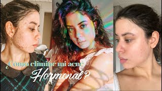 ¿CÓMO ELIMINÉ MI ACNÉ HORMONAL  SIN TOMAR ANTICONCEPTIVOS [upl. by Nemhauser165]