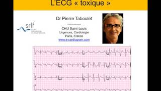 11 ECG Toxique Intoxication Réanimation Médicaments Dr Taboulet [upl. by Ariait754]