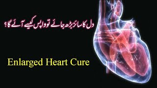 Dil ka size berh jae tou kya is ka ilaj mumkin hai  Increased Heart Size Problem [upl. by Atirehc541]