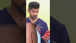 Dr Charan Reacts to AtHome Suture System Zip Stitch Safe or Scam glowwithdrcharan aesthetiq [upl. by Tham]