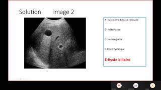 Radio  Limagerie du foie pancréas et voies biliaires [upl. by Anoynek]