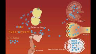 Hyperglycemia and neuropathy nephropathy and retinopathy DM complications [upl. by Walker]