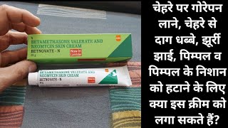 BETNOVATE N SKIN CREAM USES SIDE EFFECTS IN HINDI [upl. by Landa297]