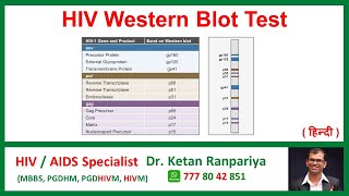 Understanding the HIV Western Blot Test Accuracy Results amp What it Means for You [upl. by Enomar236]