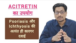 Acitretin का उपयोग  Psoriasis और Ichthyosis की अत्यंत ही कारगर दवाई Acitretin aceret actoid [upl. by Ike]