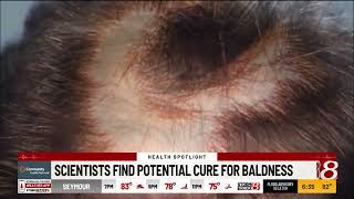 Scientists find potential cure for baldness [upl. by Madeleine]