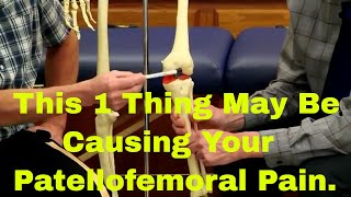 This 1 Thing May Be Causing Your Patellofemoral PainCorrect it NOW [upl. by Tatianas]