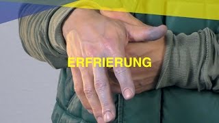 Erfrierung  MAUS Erste Hilfe Kurs  Video Tutorial [upl. by Ttehr]