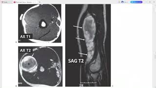 MSK 2 RAD CASE SERIES RADIOLOGY [upl. by Ataynik]