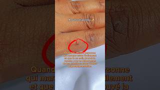 Recette efficace contre les taches dhyperpigmentation skincare shorts diy beautyhacks [upl. by Airehc43]