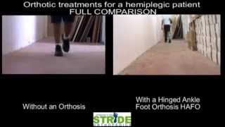 WalkAide  HAFO orthotics comparison סדים או ווקאייד השוואה [upl. by Asiruam822]