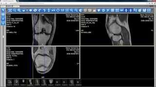 New HTML5 Zero Footprint DICOM Viewer in LEADTOOLS Version 18 [upl. by Anoirtac]