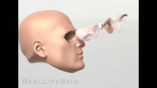 RealLifeSkin Orbital  Eye Prosthesis [upl. by Goldin182]