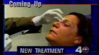 Botox Injections Can Cure Puffy Eyes [upl. by Noneek]